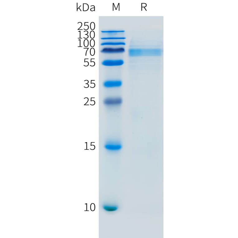 SDS-PAGE - Recombinant Mouse FCRL5 Protein (10xHis Tag) (A324736) - Antibodies.com