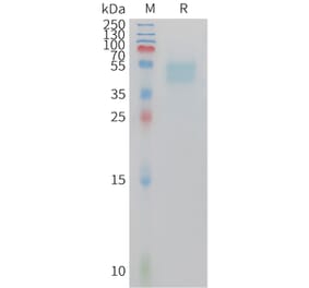 SDS-PAGE - Recombinant Mouse GIPR Protein (Fc Tag) (A324737) - Antibodies.com