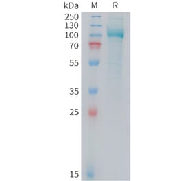 SDS-PAGE - Recombinant Mouse PSMA Protein (10xHis Tag) (A324739) - Antibodies.com