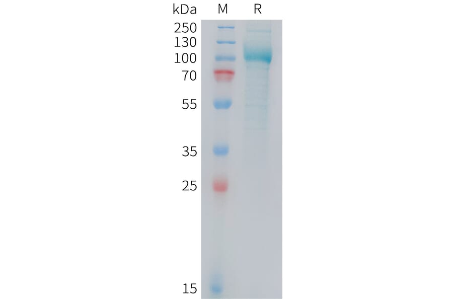 SDS-PAGE - Recombinant Mouse PSMA Protein (10xHis Tag) (A324739) - Antibodies.com