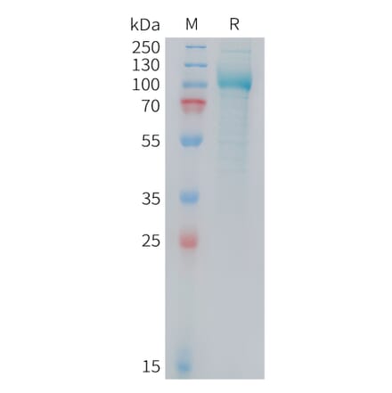 SDS-PAGE - Recombinant Mouse PSMA Protein (10xHis Tag) (A324739) - Antibodies.com