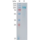 SDS-PAGE - Recombinant Mouse PSMA Protein (10xHis Tag) (A324739) - Antibodies.com