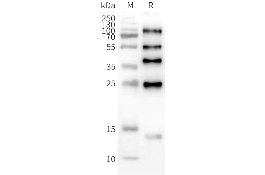 Western Blot - Synthetic Nanodisc Human ILDR2 Protein (A324778) - Antibodies.com