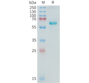 SDS-PAGE - Recombinant Cynomolgus macaque Alkaline Phosphatase Protein (10xHis Tag) (A324901) - Antibodies.com