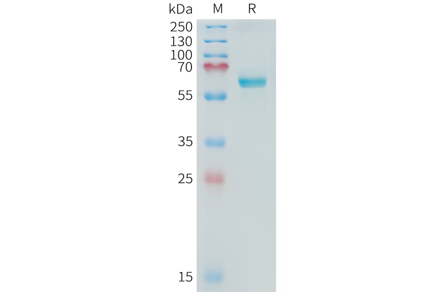 SDS-PAGE - Recombinant Cynomolgus macaque Alkaline Phosphatase Protein (10xHis Tag) (A324901) - Antibodies.com