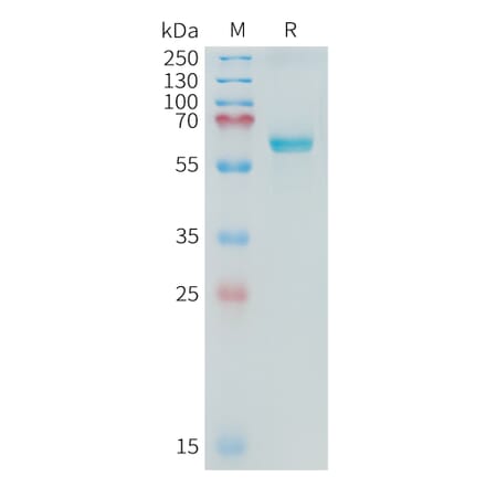 SDS-PAGE - Recombinant Cynomolgus macaque Alkaline Phosphatase Protein (10xHis Tag) (A324901) - Antibodies.com