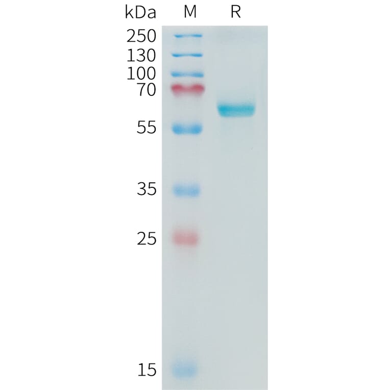 SDS-PAGE - Recombinant Cynomolgus macaque Alkaline Phosphatase Protein (10xHis Tag) (A324901) - Antibodies.com