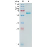 SDS-PAGE - Recombinant Cynomolgus macaque Alkaline Phosphatase Protein (10xHis Tag) (A324901) - Antibodies.com