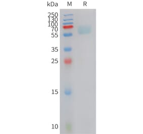 SDS-PAGE - Recombinant Cynomolgus macaque Axl Protein (10xHis Tag) (A324902) - Antibodies.com