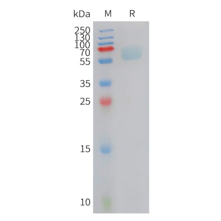 SDS-PAGE - Recombinant Cynomolgus macaque Axl Protein (10xHis Tag) (A324902) - Antibodies.com