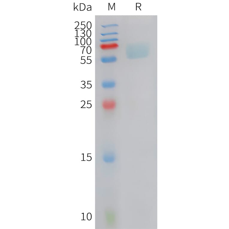 SDS-PAGE - Recombinant Cynomolgus macaque Axl Protein (10xHis Tag) (A324902) - Antibodies.com