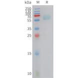 SDS-PAGE - Recombinant Cynomolgus macaque Axl Protein (10xHis Tag) (A324902) - Antibodies.com