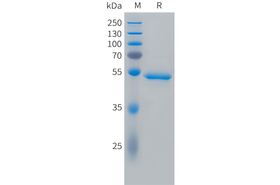 SDS-PAGE - Recombinant Cynomolgus macaque Carbonic Anhydrase 9/CA9 Protein (10xHis Tag) (A324903) - Antibodies.com