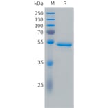 SDS-PAGE - Recombinant Cynomolgus macaque Carbonic Anhydrase 9/CA9 Protein (10xHis Tag) (A324903) - Antibodies.com