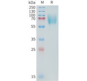 SDS-PAGE - Recombinant Cynomolgus macaque CD276 Protein (10xHis Tag) (A324904) - Antibodies.com