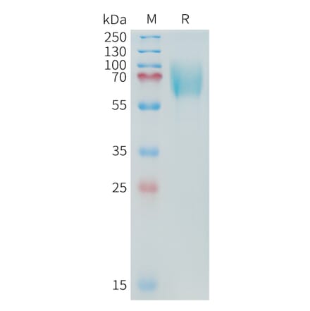 SDS-PAGE - Recombinant Cynomolgus macaque CD276 Protein (10xHis Tag) (A324904) - Antibodies.com