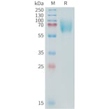 SDS-PAGE - Recombinant Cynomolgus macaque CD276 Protein (10xHis Tag) (A324904) - Antibodies.com