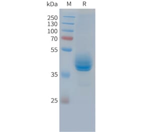 SDS-PAGE - Recombinant Cynomolgus macaque CD3 epsilon Protein (Fc Tag) (A324905) - Antibodies.com