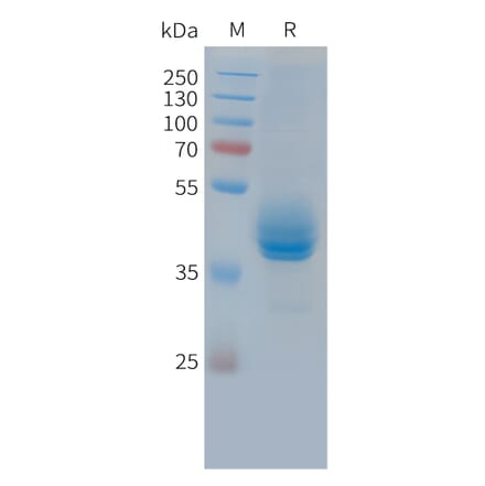 SDS-PAGE - Recombinant Cynomolgus macaque CD3 epsilon Protein (Fc Tag) (A324905) - Antibodies.com