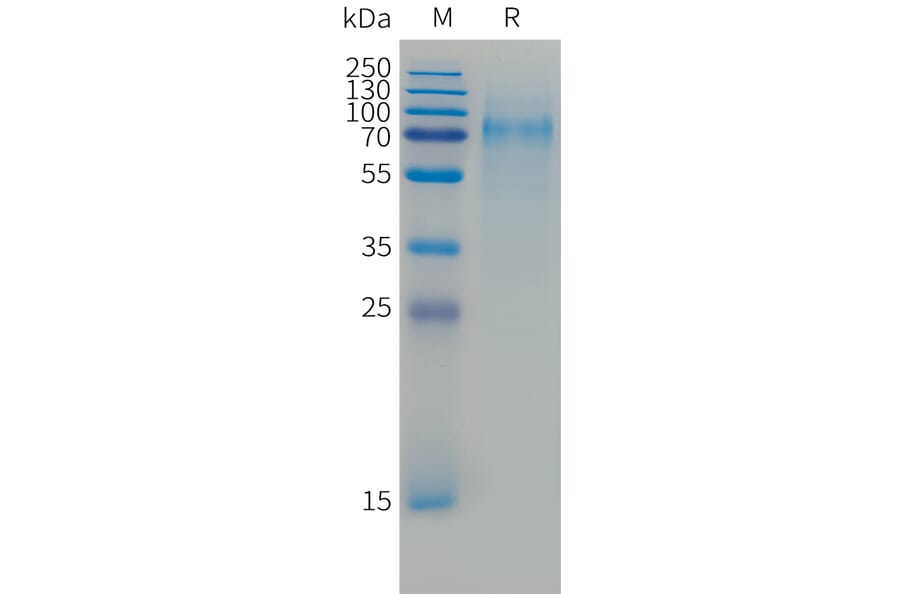 SDS-PAGE - Recombinant Cynomolgus macaque CD30 Protein (10xHis Tag) (A324906) - Antibodies.com
