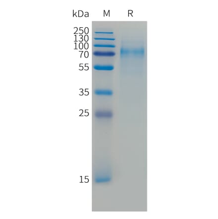 SDS-PAGE - Recombinant Cynomolgus macaque CD30 Protein (10xHis Tag) (A324906) - Antibodies.com