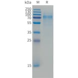 SDS-PAGE - Recombinant Cynomolgus macaque CD30 Protein (10xHis Tag) (A324906) - Antibodies.com