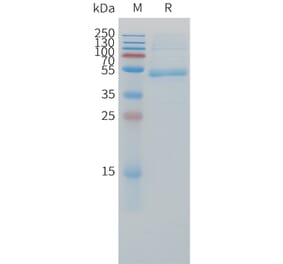 SDS-PAGE - Recombinant Cynomolgus macaque CD79b Protein (Fc Tag) (A324907) - Antibodies.com