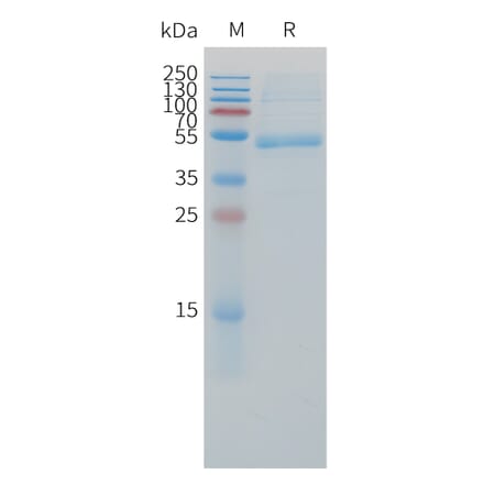 SDS-PAGE - Recombinant Cynomolgus macaque CD79b Protein (Fc Tag) (A324907) - Antibodies.com
