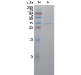 SDS-PAGE - Recombinant Cynomolgus macaque Claudin18.2 Protein (Fc Tag) (A324908) - Antibodies.com
