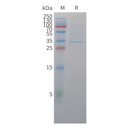 SDS-PAGE - Recombinant Cynomolgus macaque Claudin18.2 Protein (Fc Tag) (A324908) - Antibodies.com