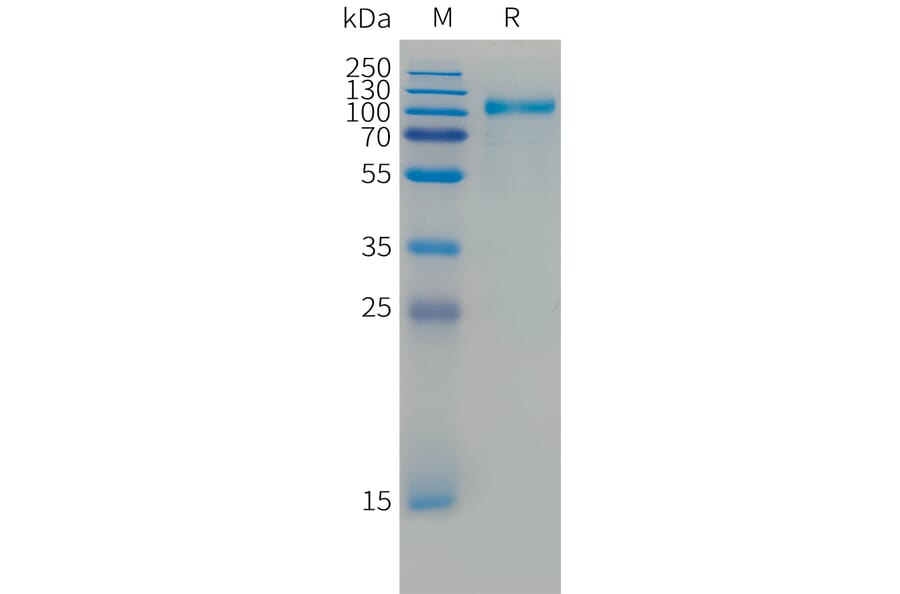 SDS-PAGE - Recombinant Cynomolgus macaque ErbB3/HER3 Protein (10xHis Tag) (A324909) - Antibodies.com