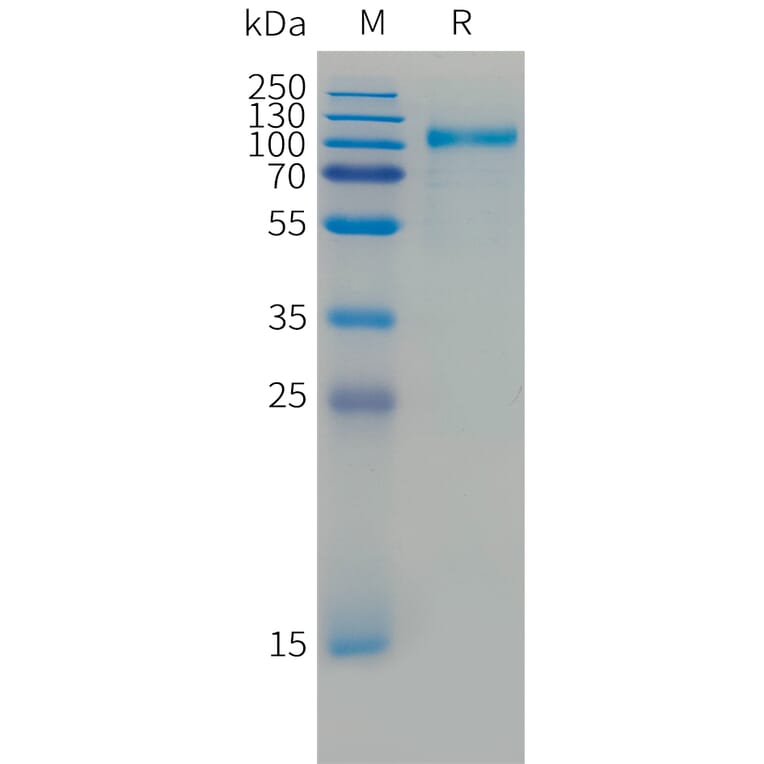 SDS-PAGE - Recombinant Cynomolgus macaque ErbB3/HER3 Protein (10xHis Tag) (A324909) - Antibodies.com