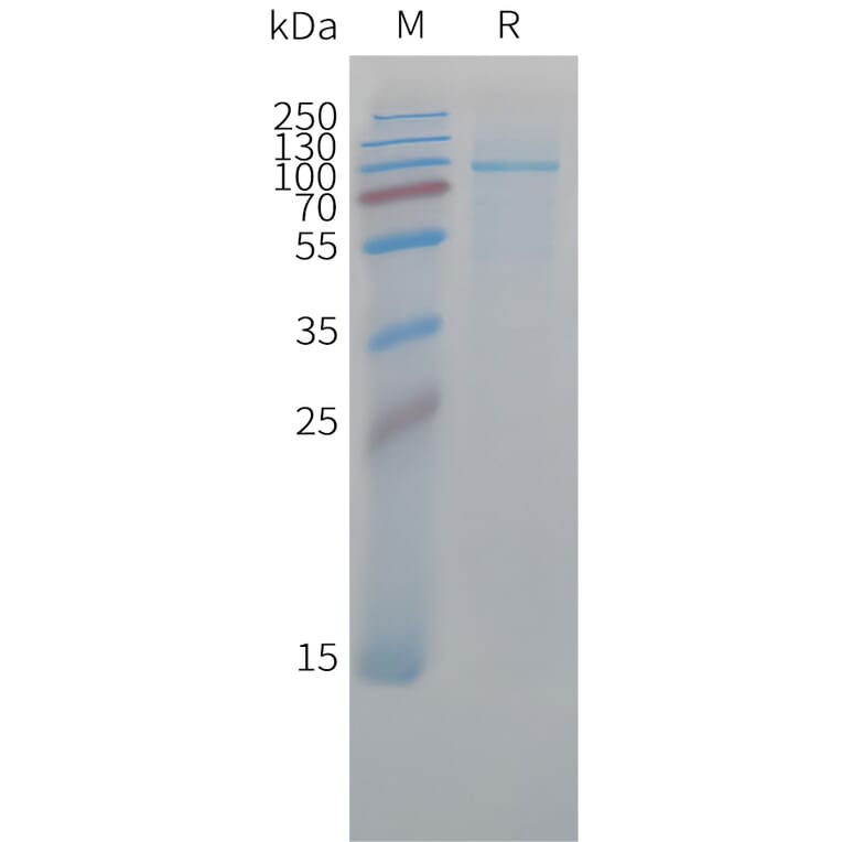 SDS-PAGE - Recombinant Cynomolgus macaque Fibroblast Activation Protein alpha/FAP Protein (10xHis Tag) (A324910) - Antibodies.com