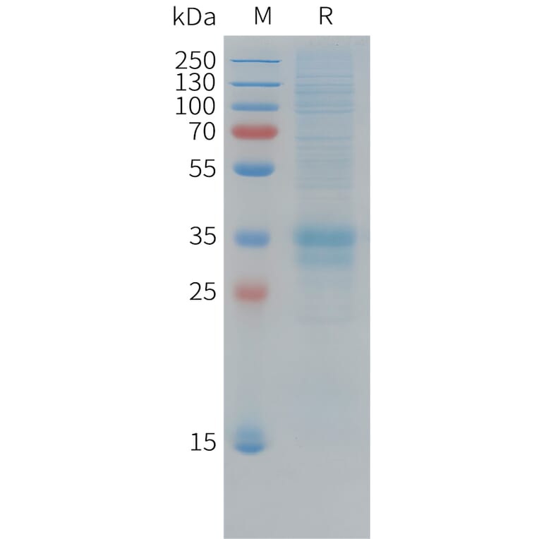 SDS-PAGE - Recombinant Cynomolgus macaque Folate Binding Protein/FBP Protein (10xHis Tag) (A324911) - Antibodies.com