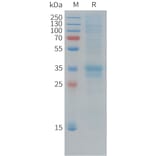 SDS-PAGE - Recombinant Cynomolgus macaque Folate Binding Protein/FBP Protein (10xHis Tag) (A324911) - Antibodies.com