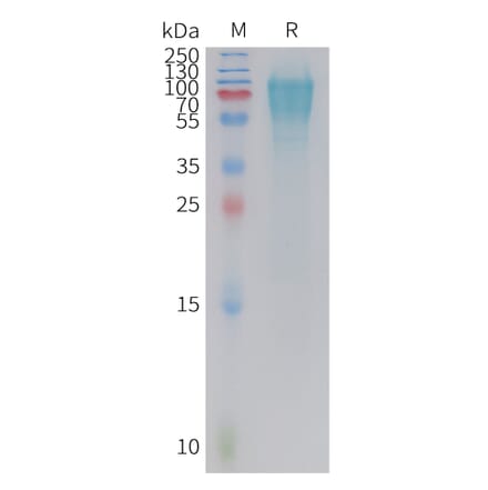 SDS-PAGE - Recombinant Cynomolgus macaque GC-C Protein (10xHis Tag) (A324912) - Antibodies.com
