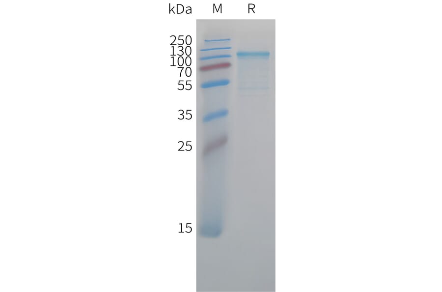 SDS-PAGE - Recombinant Cynomolgus macaque K Cadherin/CDH6 Protein (10xHis Tag) (A324913) - Antibodies.com