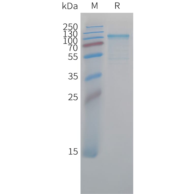 SDS-PAGE - Recombinant Cynomolgus macaque K Cadherin/CDH6 Protein (10xHis Tag) (A324913) - Antibodies.com