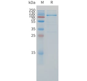SDS-PAGE - Recombinant Cynomolgus macaque LAG-3 Protein (Fc Tag) (A324914) - Antibodies.com