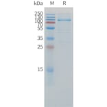 SDS-PAGE - Recombinant Cynomolgus macaque LAG-3 Protein (Fc Tag) (A324914) - Antibodies.com