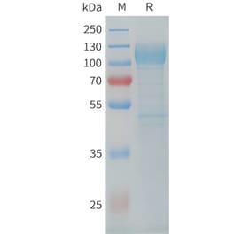 SDS-PAGE - Recombinant Cynomolgus macaque LI Cadherin Protein (10xHis Tag) (A324915) - Antibodies.com