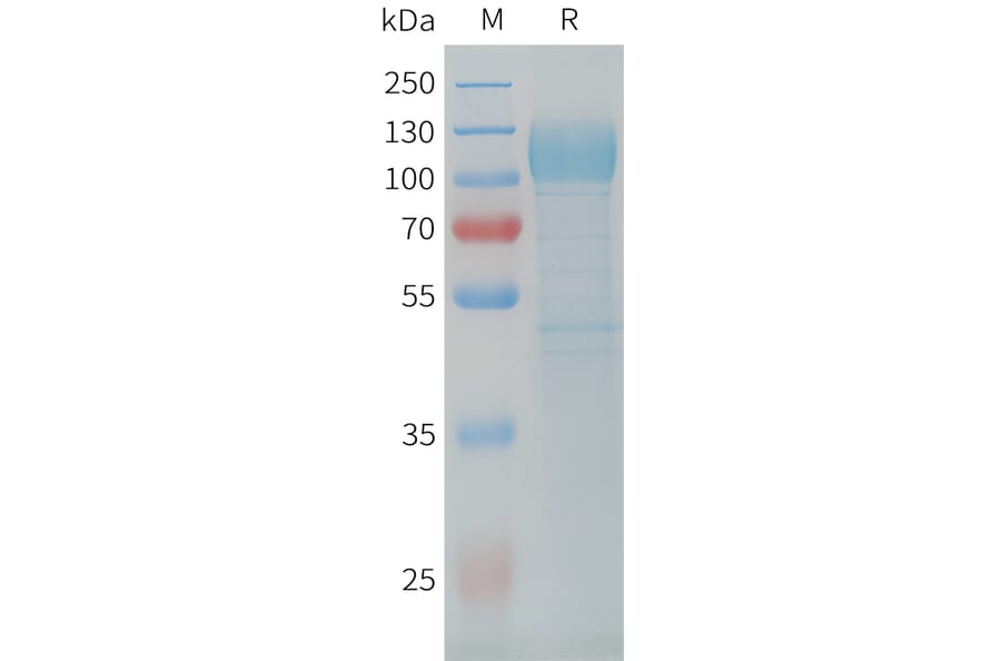 SDS-PAGE - Recombinant Cynomolgus macaque LI Cadherin Protein (10xHis Tag) (A324915) - Antibodies.com