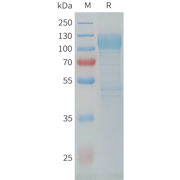 SDS-PAGE - Recombinant Cynomolgus macaque LI Cadherin Protein (10xHis Tag) (A324915) - Antibodies.com