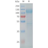SDS-PAGE - Recombinant Cynomolgus macaque LI Cadherin Protein (10xHis Tag) (A324915) - Antibodies.com