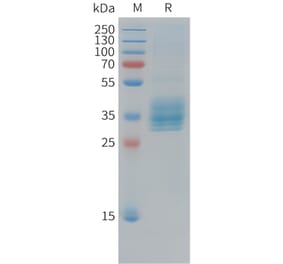 SDS-PAGE - Recombinant Cynomolgus macaque Mesothelin Protein (10xHis Tag) (A324916) - Antibodies.com