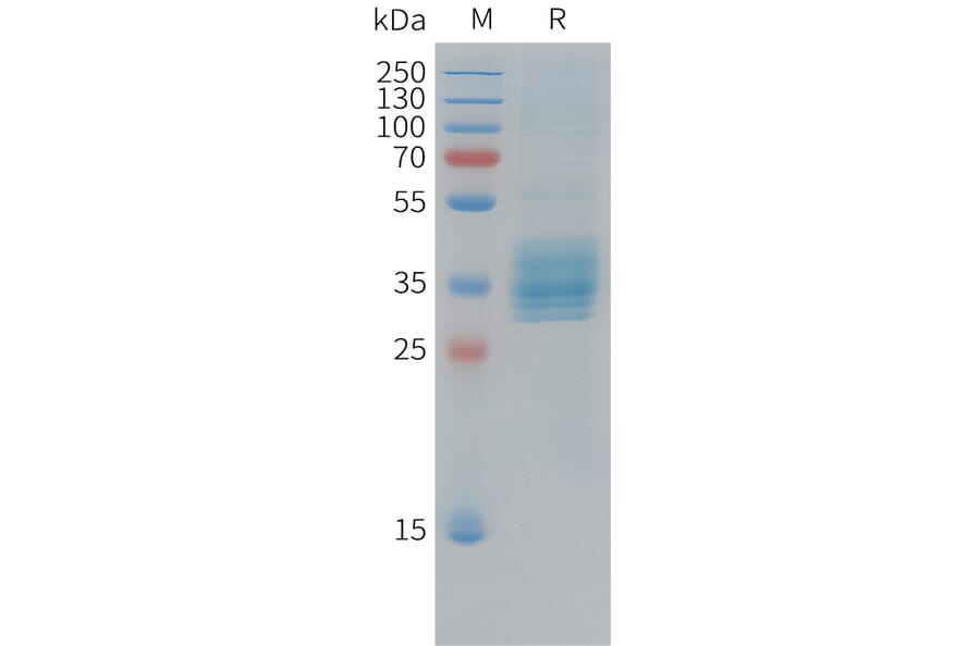 SDS-PAGE - Recombinant Cynomolgus macaque Mesothelin Protein (10xHis Tag) (A324916) - Antibodies.com