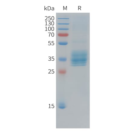 SDS-PAGE - Recombinant Cynomolgus macaque Mesothelin Protein (10xHis Tag) (A324916) - Antibodies.com