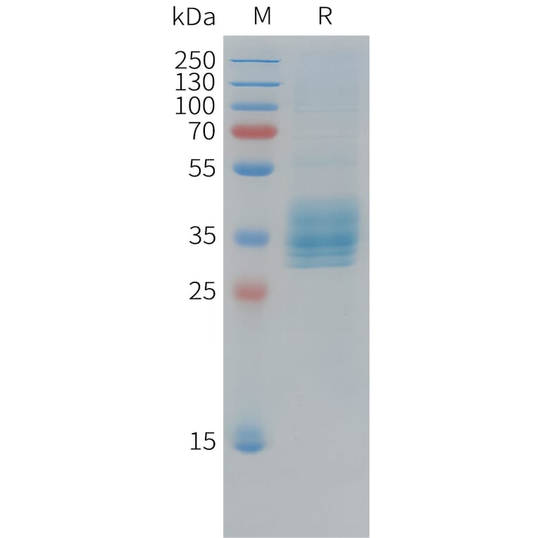 SDS-PAGE - Recombinant Cynomolgus macaque Mesothelin Protein (10xHis Tag) (A324916) - Antibodies.com