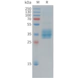 SDS-PAGE - Recombinant Cynomolgus macaque Mesothelin Protein (10xHis Tag) (A324916) - Antibodies.com