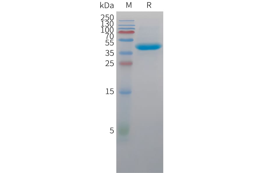 SDS-PAGE - Recombinant Cynomolgus macaque Nectin-4 Protein (10xHis Tag) (A324917) - Antibodies.com